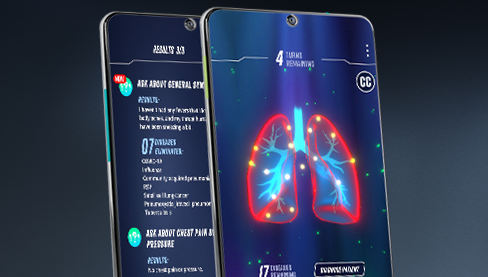 Pulm Ex Covid-19 Cases