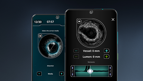 Cardio Ex IVUS Training