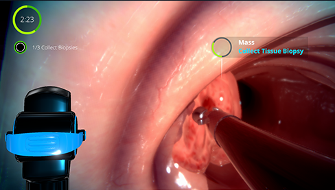 Pulm Ex Oncology Challenges