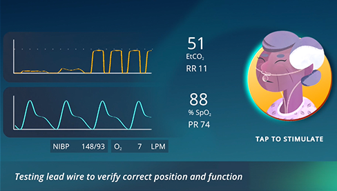 Airway Ex Patient Monitoring Challenges