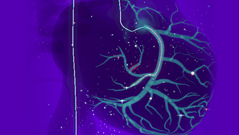 Cardio Ex Procedural Levels