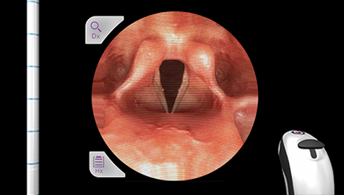 Airway Ex Real Anesthesiology Cases