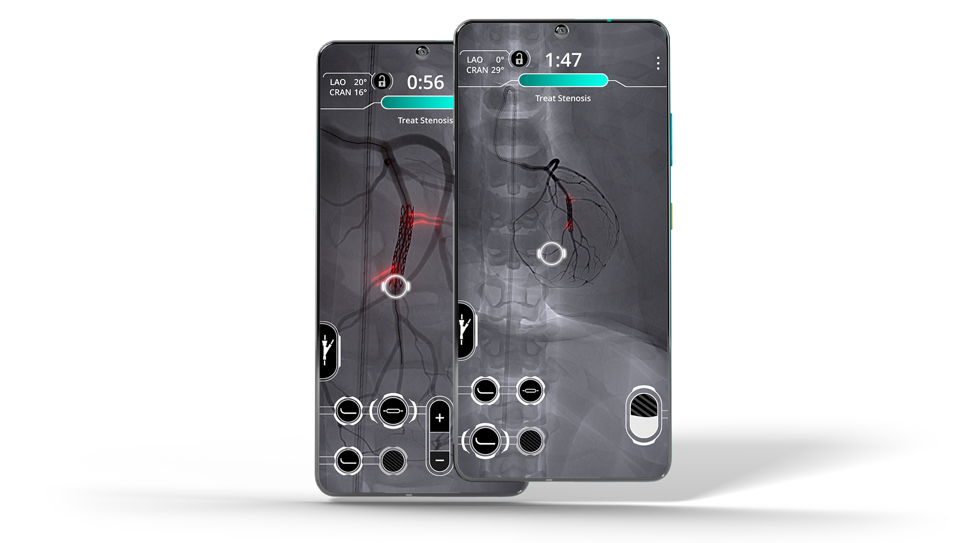 Cardio ex online