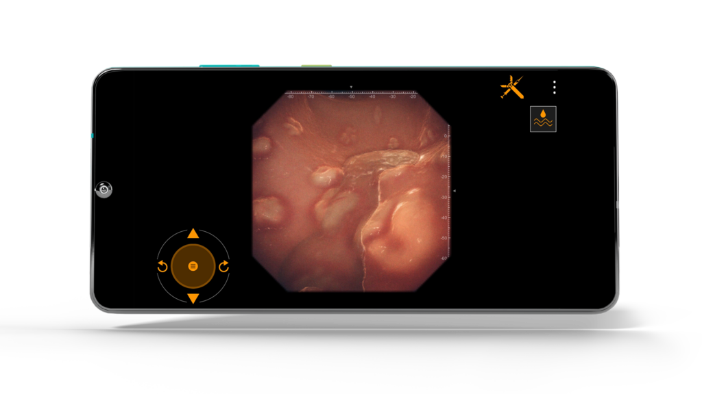 Gastro Ex screenshot featuring Pooling Flow