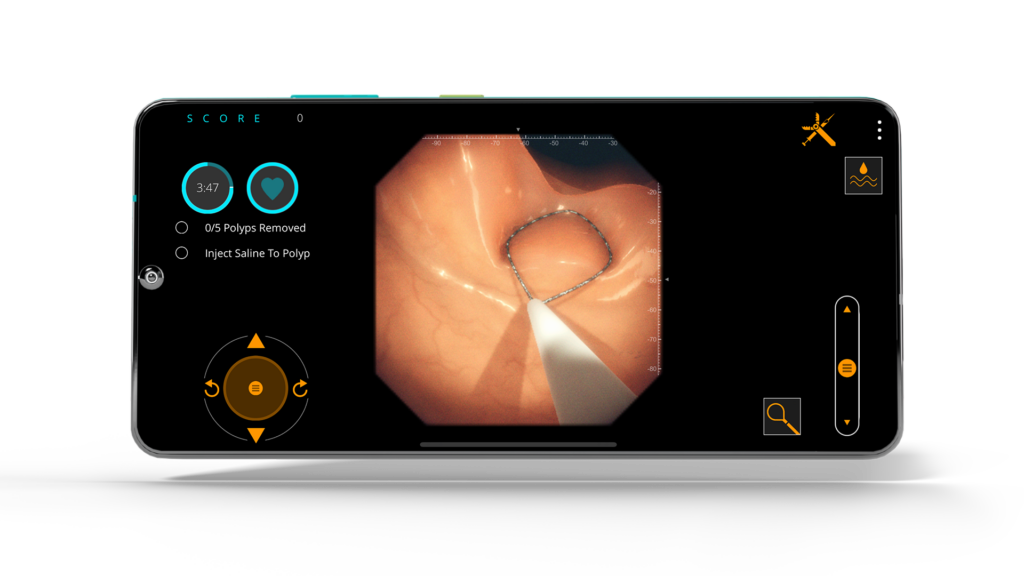 Gastro Ex screenshot featuring Cold Snare manipulating tissue