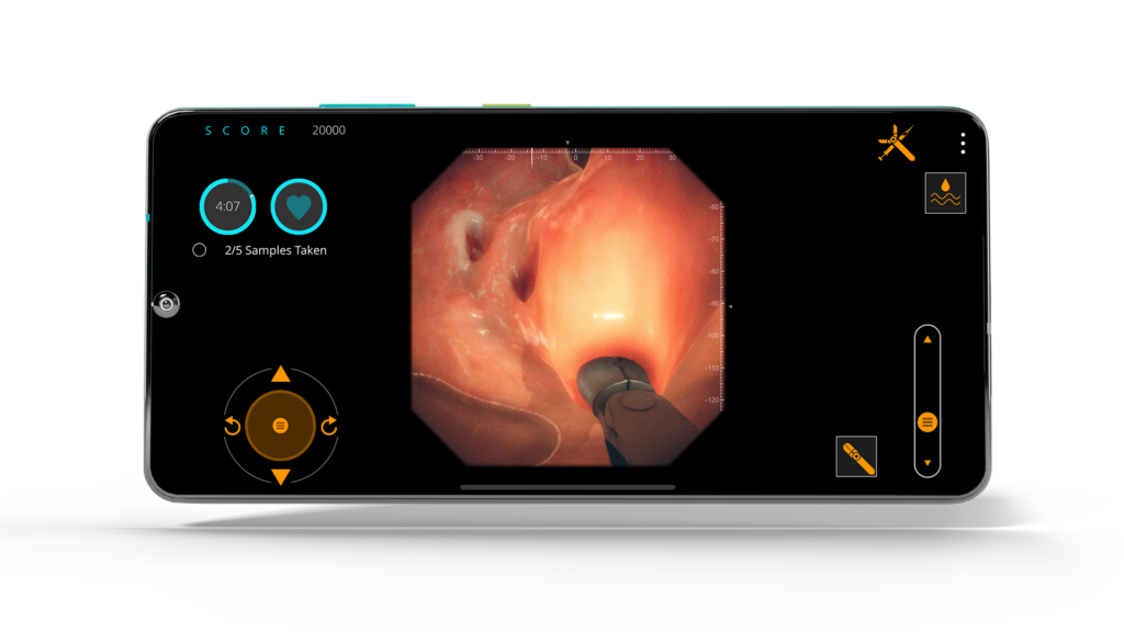 Gastro Ex screenshot featuring Device Forcep Pulling Polyp