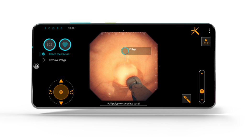 Gastro Ex screenshot featuring Device Forcep Pulling Polyp