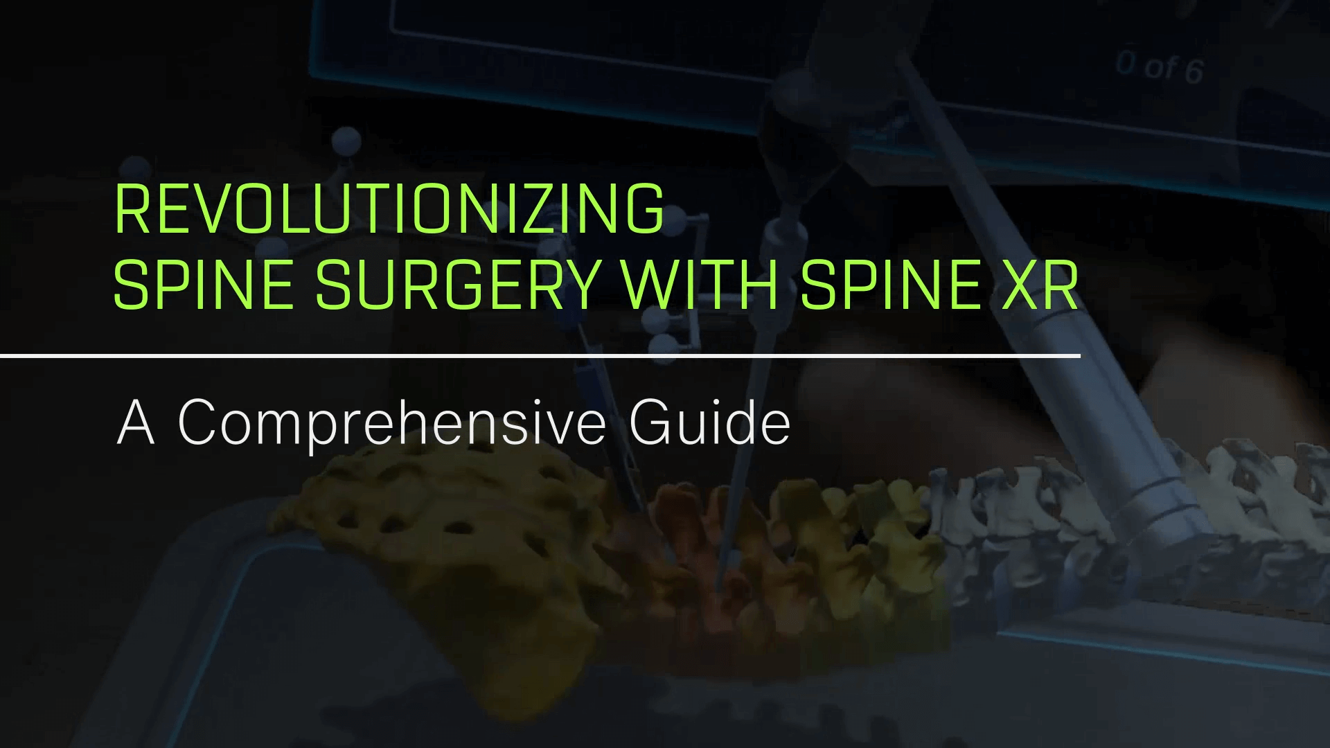 Revolutionizing Spine Surgery with Spine XR: A Comprehensive Guide